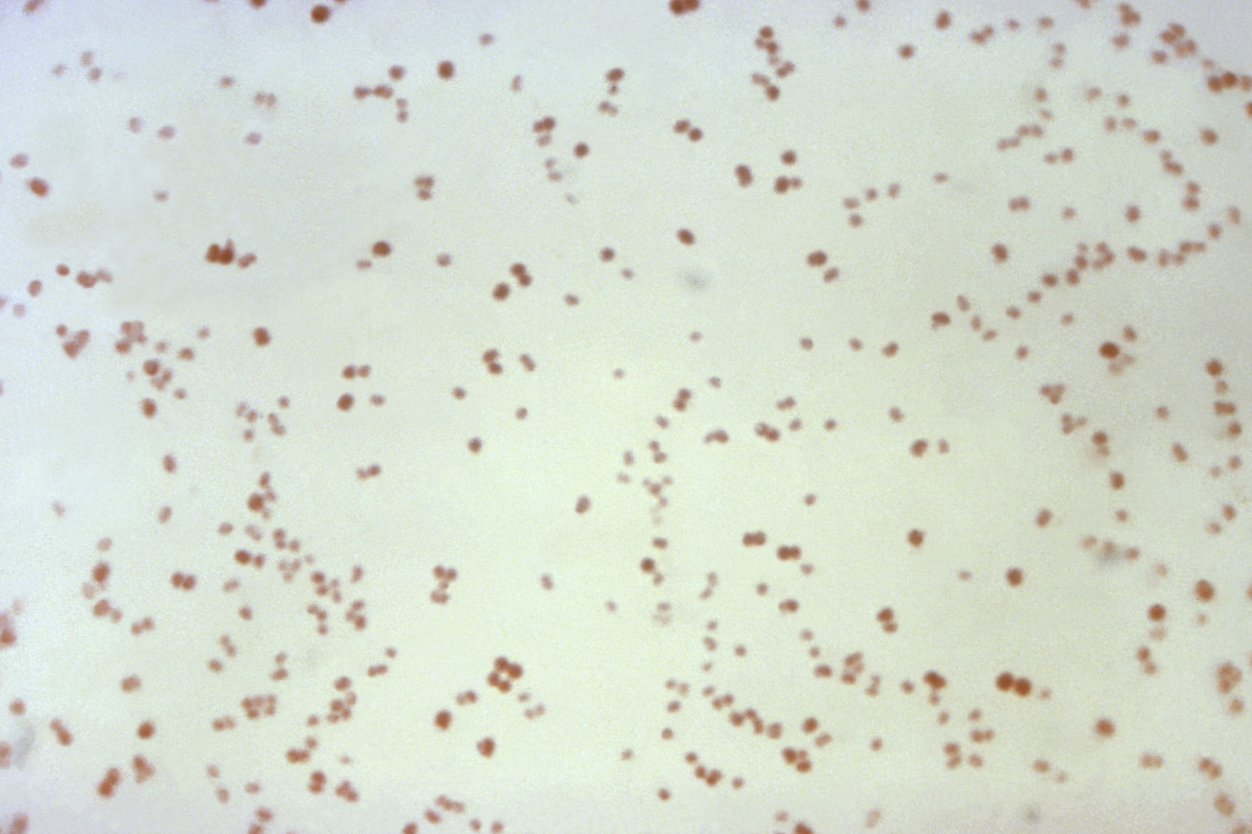 Superbugs